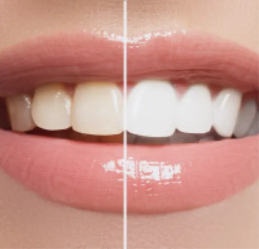 Cosmetic Dentistry